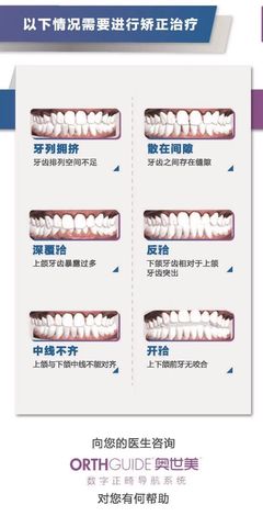 牙齿矫正时间要多久