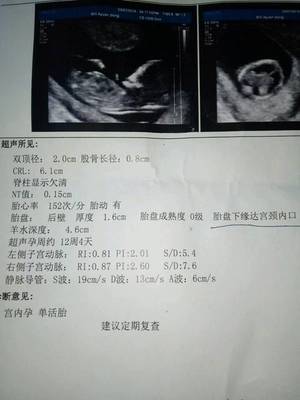 怎么测试男女宝宝最准