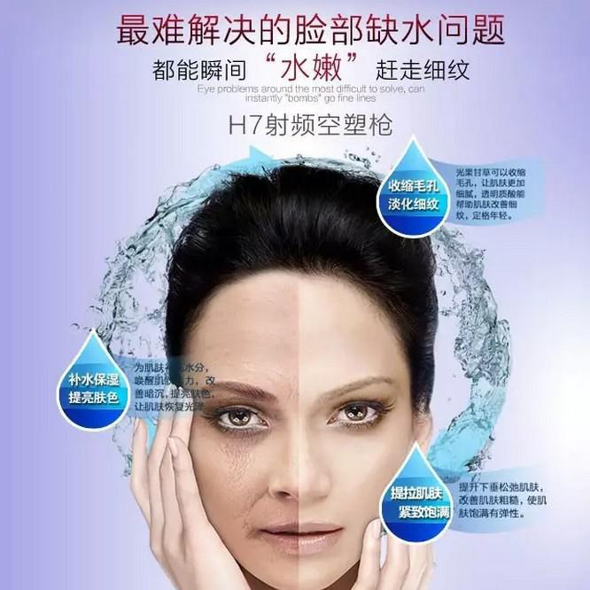 脸部射频