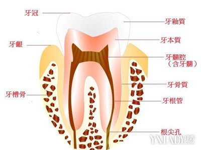 残髓炎怎么治疗
