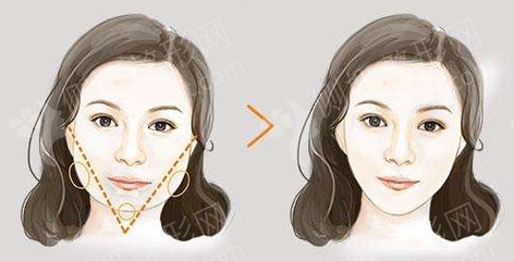 脸部麻木是怎么回事