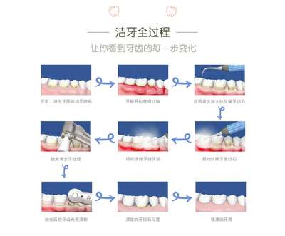 洗牙怎么洗用什么洗