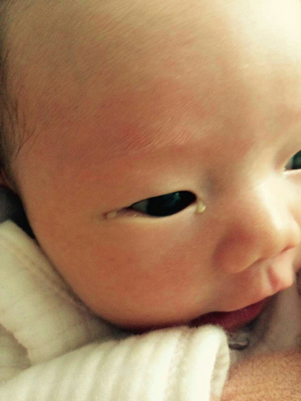 一个多月的宝宝有眼屎怎么回事