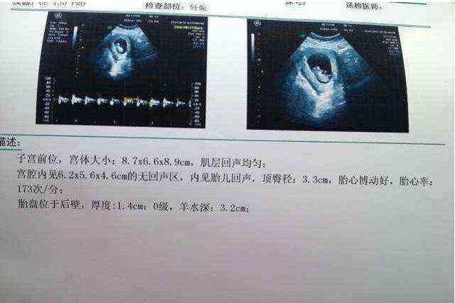 孕妇可以看新生儿吗