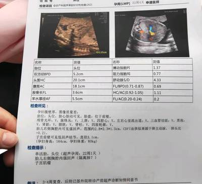 胎儿fl标准对照表