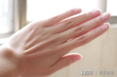 指甲上有黑纹是怎么回事