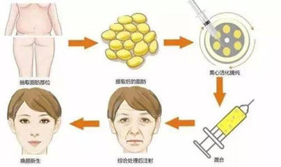 痘痘肌可以用玻尿酸吗