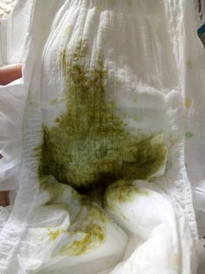 拉的粑粑是绿色的怎么回事