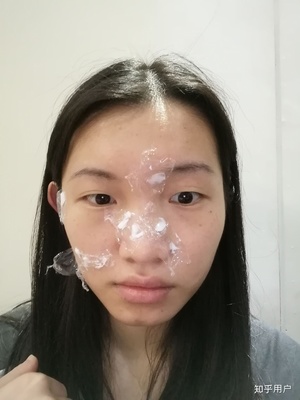 哪里祛痣比较好