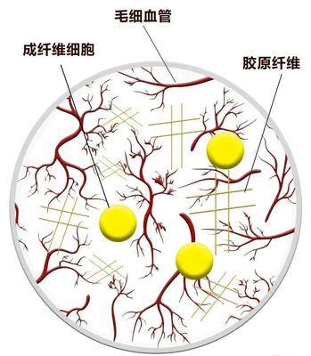 怎样能治好痘痘