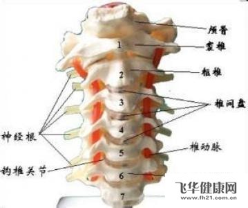 神经根颈椎病怎么治疗最好