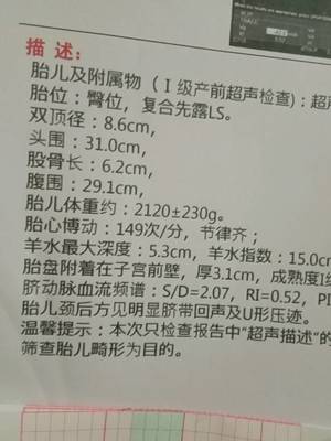 34周股骨长标准是多少