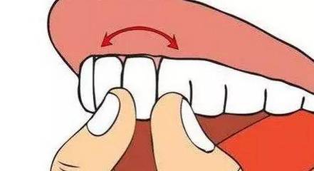 口腔出血是什么原因
