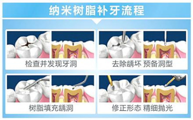 牙齿修正大概多少钱一个