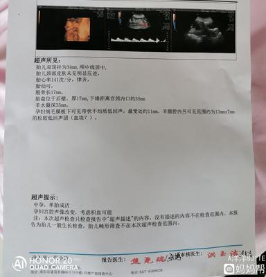 怀孕十四周是多少天