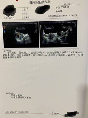 刚怀孕一周会恶心吗
