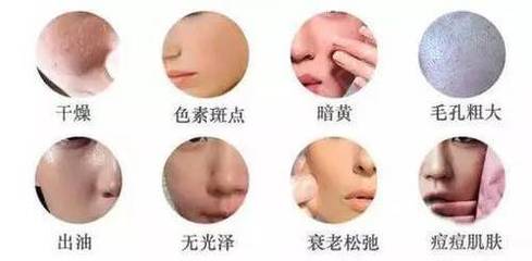 痘痘破了能用玻尿酸吗