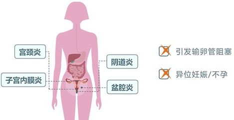 药流后会影响以后怀孕吗