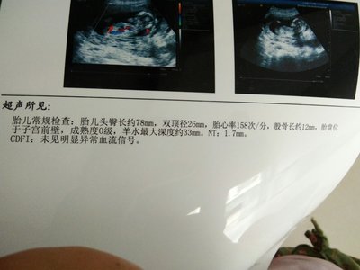 怀孕三个月宝宝