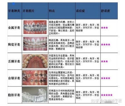 在深圳做牙套多少钱一颗