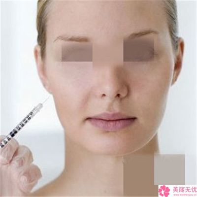 玻尿酸丰面颊费用