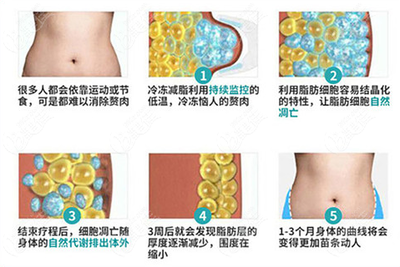 抽脂融脂