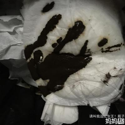 拉黑色粑粑是怎么回事