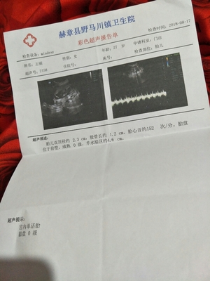 14周是多少个月