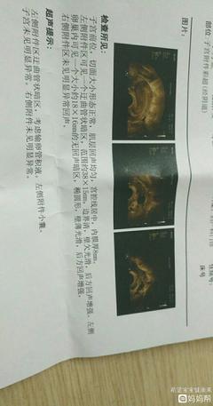 排卵期卵泡多大容易怀孕