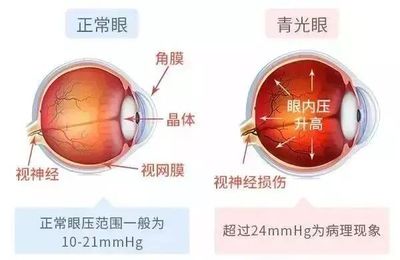 小孩眼底发青是怎么回事