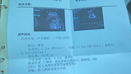 胎儿七个月双顶径标准