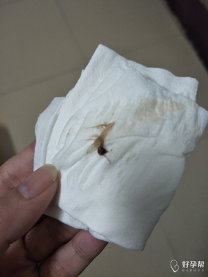 排卵期白带有血丝怎么回事