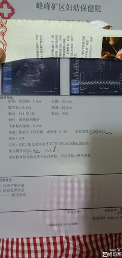 32周胎宝宝