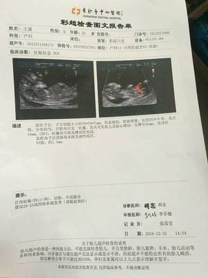 怀孕多久做nt和唐筛