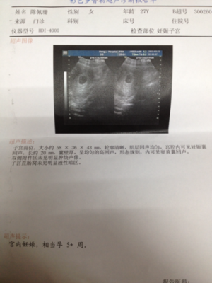 怀孕五周见红怎么回事