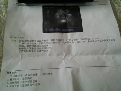 怀孕出血量