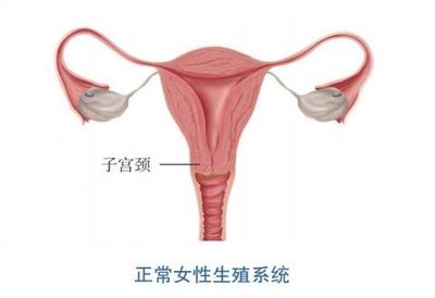 宫颈肿瘤怎么治疗