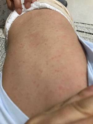小孩晚上咳嗽吐
