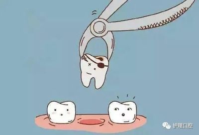牙疼的时候可以拔牙吗?牙齿坏了怎么处理?