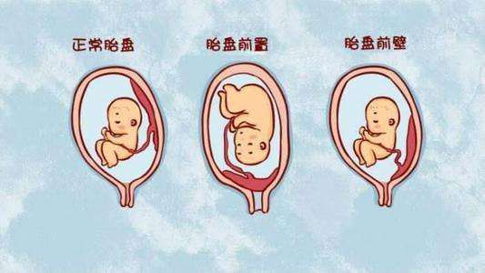 怀孕可以请长假吗
