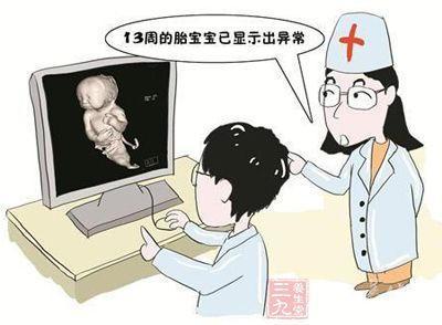 宝宝做核磁共振