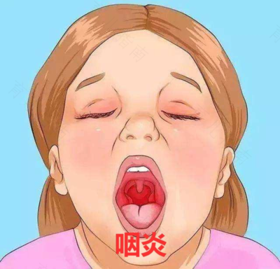 宝宝咽喉炎怎么办