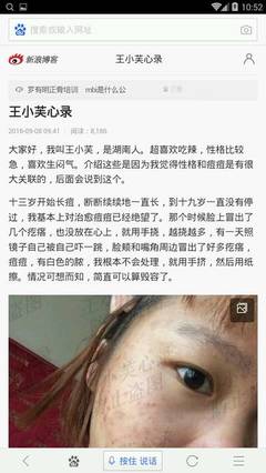 痘痘方法的博客