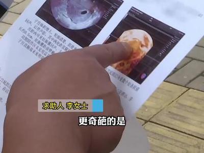请问上环会怀孕吗