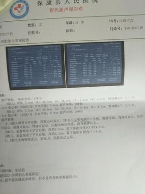 孕29周是几个月