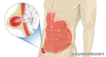 带状疱疹可以怀孕吗