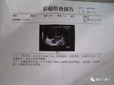 怀孕可以做婚检吗