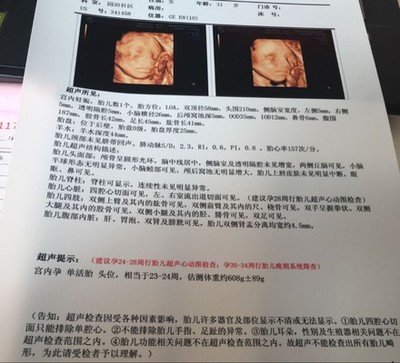 二十周的胎儿有多大