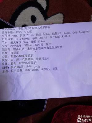 胎儿sd值偏高怎么回事