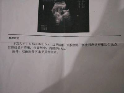 做完人流半个月来月经